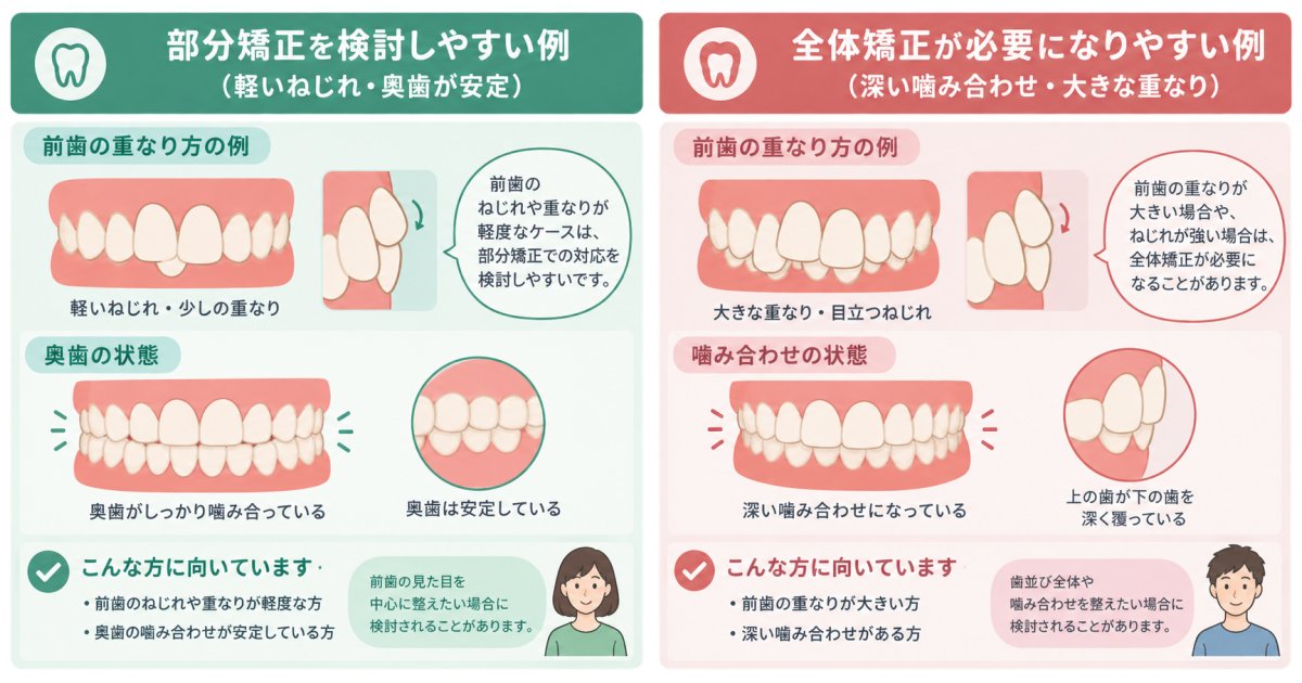 前歯が重なるのはなぜ?部分矯正で直せるのはどんな重なり方?